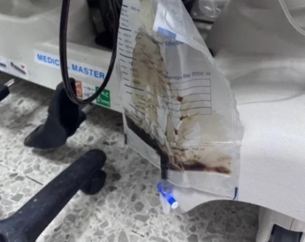 股牛网 泰国中学生迟交作业被罚深蹲200次，横纹肌溶解尿液变黑